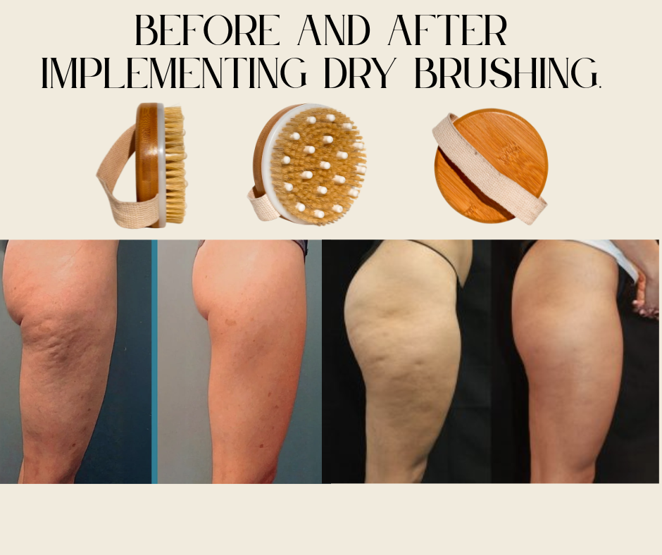 lymphatic draining dry body brush.